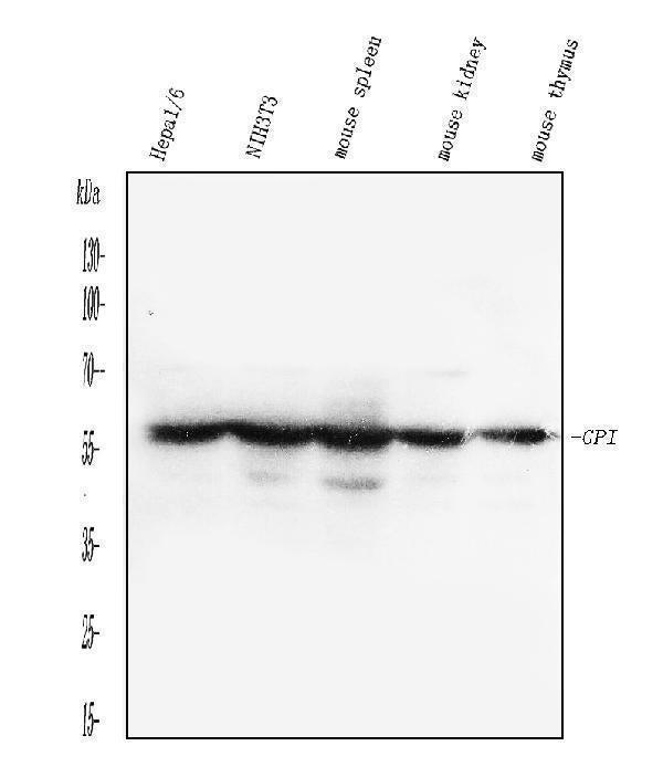 Anti-Glucose 6 phosphate isomerase/GPI Antibody Picoband®