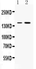 Anti-Insulin Receptor/INSR Antibody Picoband®