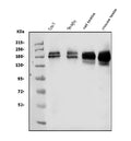 Anti-KDM5B/PLU1/Jarid1B Antibody Picoband®