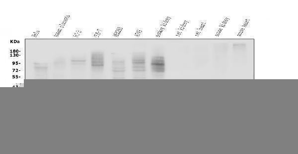 Anti-Lactate Dehydrogenase B/LDHB Antibody Picoband®