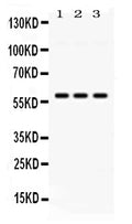 Anti-E3 SUMO-protein ligase PIAS4 Antibody Picoband®