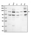 Anti-PML Protein Antibody Picoband®