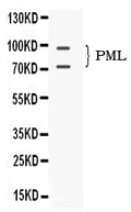 Anti-PML Protein Antibody Picoband®