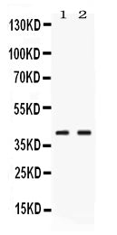 Anti-Phosphoserine Aminotransferase/PSAT1 Antibody Picoband®