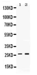 Anti-Proteasome 20S alpha 2/PSMA2 Antibody Picoband®