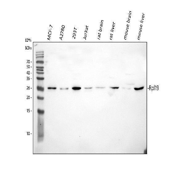 Anti-RPL19 Antibody Picoband®