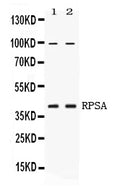 Anti-67kDa Laminin Receptor/RPSA Antibody Picoband®