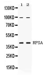 Anti-67kDa Laminin Receptor/RPSA Antibody Picoband®