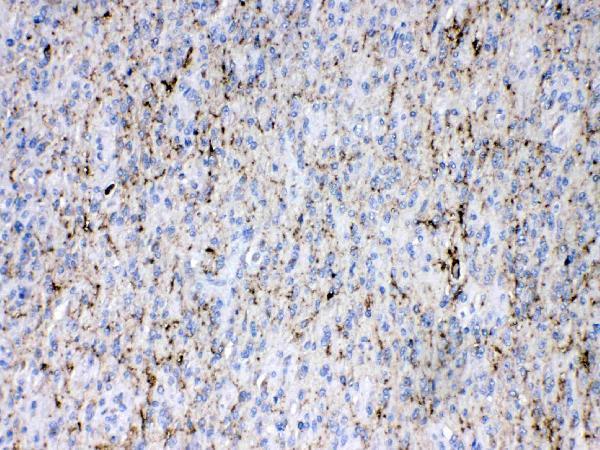 Anti-Synapsin I/SYN1 Antibody Picoband®