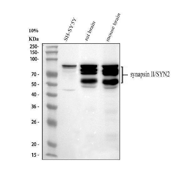 Anti-Synapsin II/SYN2 Antibody Picoband®