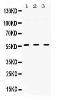 Anti-TGF beta Receptor I/TGFBR1 Antibody Picoband®