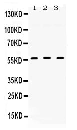Anti-TGF beta Receptor I/TGFBR1 Antibody Picoband®
