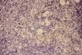 Anti-GM-CSF/CSF2 Antibody Picoband®