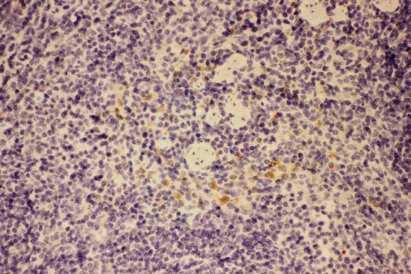 Anti-GM-CSF/CSF2 Antibody Picoband®