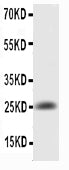 Anti-IL6 Antibody Picoband®