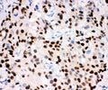 Anti-Progesterone Receptor/PGR Antibody Picoband®