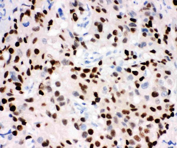 Anti-Progesterone Receptor/PGR Antibody Picoband®