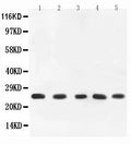 Anti-TNF alpha Antibody Picoband®