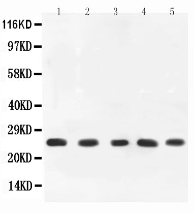 Anti-TNF alpha Antibody Picoband®
