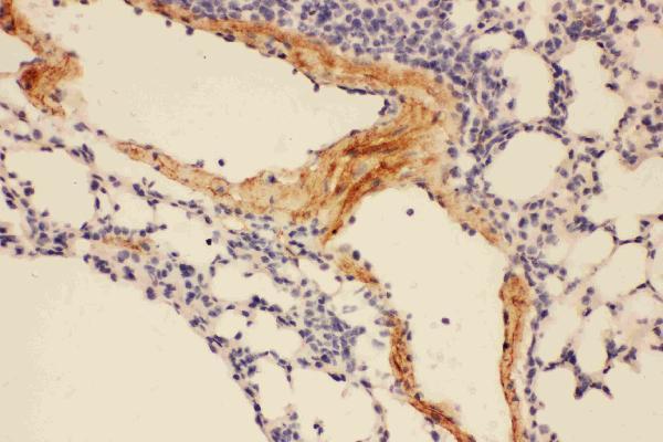 Anti-Adiponectin/ADIPOQ Antibody Picoband®