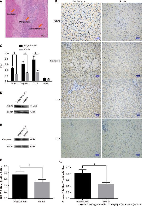 Anti-IL18 Antibody Picoband®