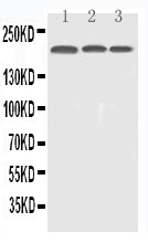 Anti-EGFR Antibody Picoband®