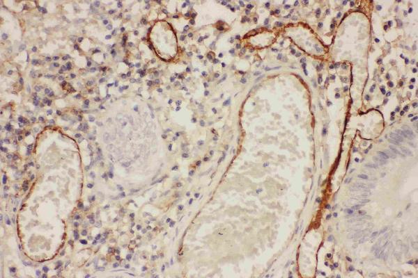 Anti-ICAM1 Antibody Picoband®
