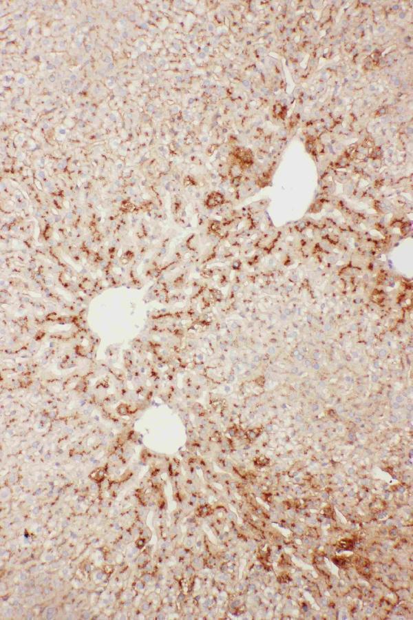 Anti-Serum Amyloid P/APCS Antibody Picoband®