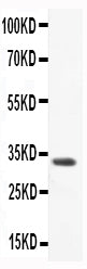 Anti-CCL3/Macrophage Inflammatory Protein 1 alpha Antibody Picoband®