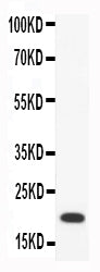 Anti-Macrophage Inflammatory Protein 4/CCL18 Antibody Picoband®
