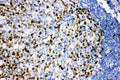 Anti-Ki67/MKI67 Antibody Picoband®