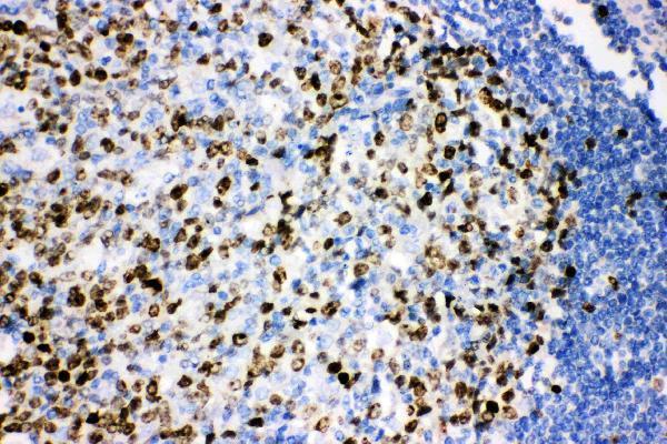 Anti-Ki67/MKI67 Antibody Picoband®