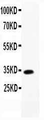 Anti-TARC/CCL17 Antibody Picoband®