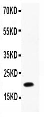Anti-IL-12(p40) Picoband antibody, RP1028
All lanes: Anti-IL-12(p40)(RP1028) at 0.5ug/ml
WB: Recombinant Rat IL-12(p40) Protein 0.5ng
Predicted bind size: 20KD
Observed bind size: 20KD