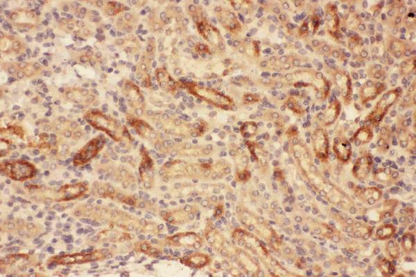 Anti-MMP7 Antibody Picoband®