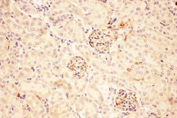 Anti-ACTH/POMC Antibody