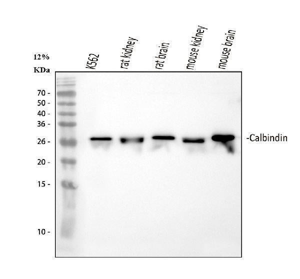 Anti-Calbindin/CALB1 Antibody Picoband®