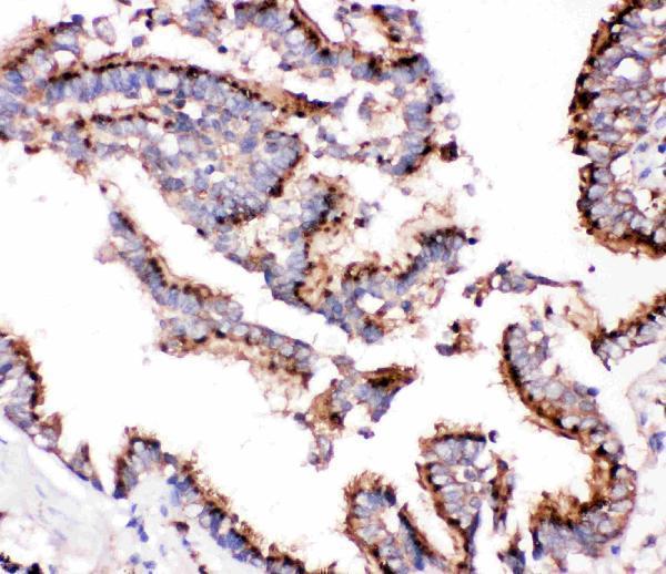 Anti-Cathepsin D/CTSD Antibody Picoband®