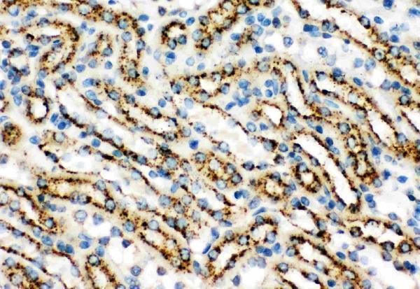 Anti-Cathepsin D/CTSD Antibody Picoband®