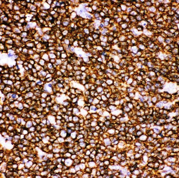 Anti-CD20/MS4A1 Antibody Picoband®