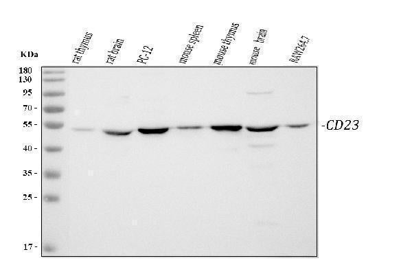 Anti-CD23/FCER2 Antibody Picoband®