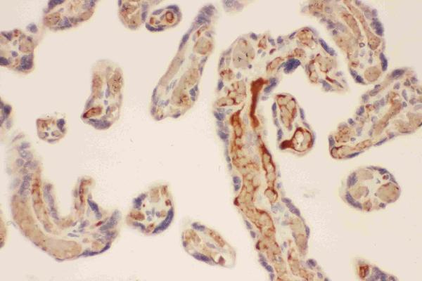 Anti-Mast Cell Chymase/CMA1 Antibody Picoband®