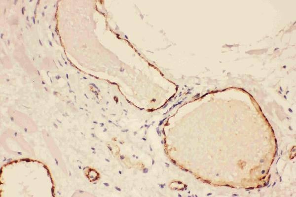 Anti-Von Willebrand Factor/VWF Antibody Picoband®