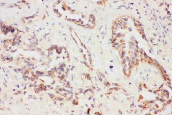 Anti-Eotaxin 3/CCL26 Antibody Picoband®