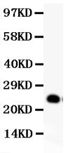 Anti-GDNF Antibody Picoband®