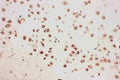 Anti-ALOX5 Picoband antibody, RP1031-1.JPG
IHC(P): Mouse Brain Tissue