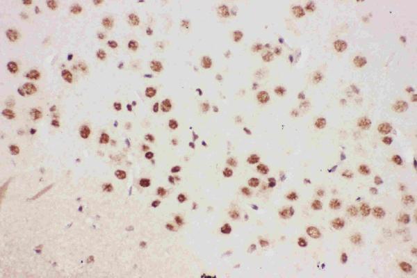 Anti-ALOX5 Picoband antibody, RP1031-1.JPG
IHC(P): Mouse Brain Tissue