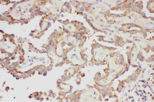Anti-Galectin 3/LGALS3 Antibody Picoband®