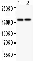 Anti-Collagen III Picoband antibody, RP1033-2.jpg
All lanes: Anti Collagen III(RP1033) at 0.5ug/ml
Lane 1: MCF-4 Whole Cell Lysate at 40ug
Lane 2: COLO320 Whole Cell Lysate at 40ug
Predicted bind size: 139KD
Observed bind size: 139KD