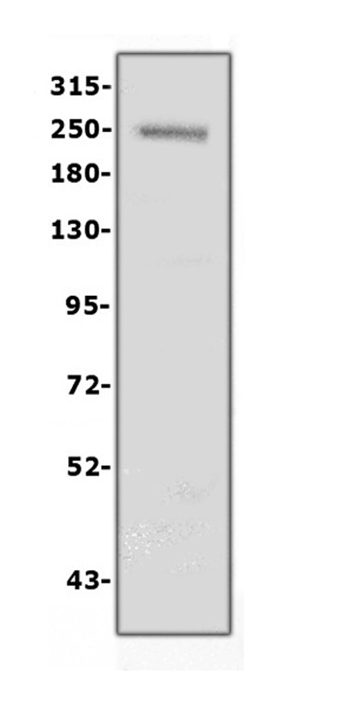 Anti-Collagen IV/COL4A1 Antibody Picoband®